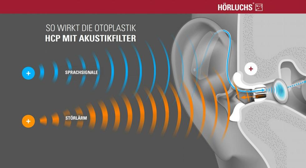 Hörluchs Hörgeräteversorgung